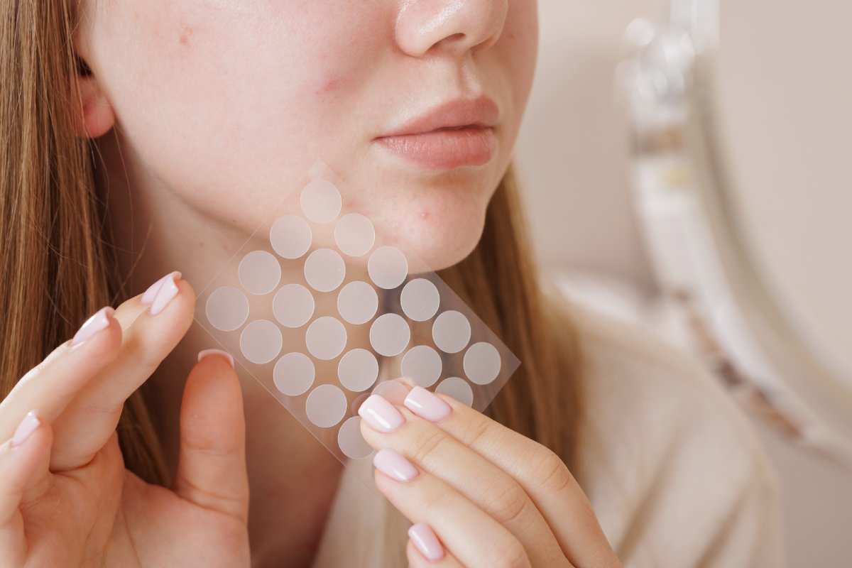Do Pimple Patches Really Work? Dermatologist-Approved Tips for Clearer Skin